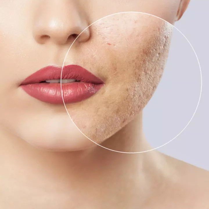 best scar treatment in dehradun